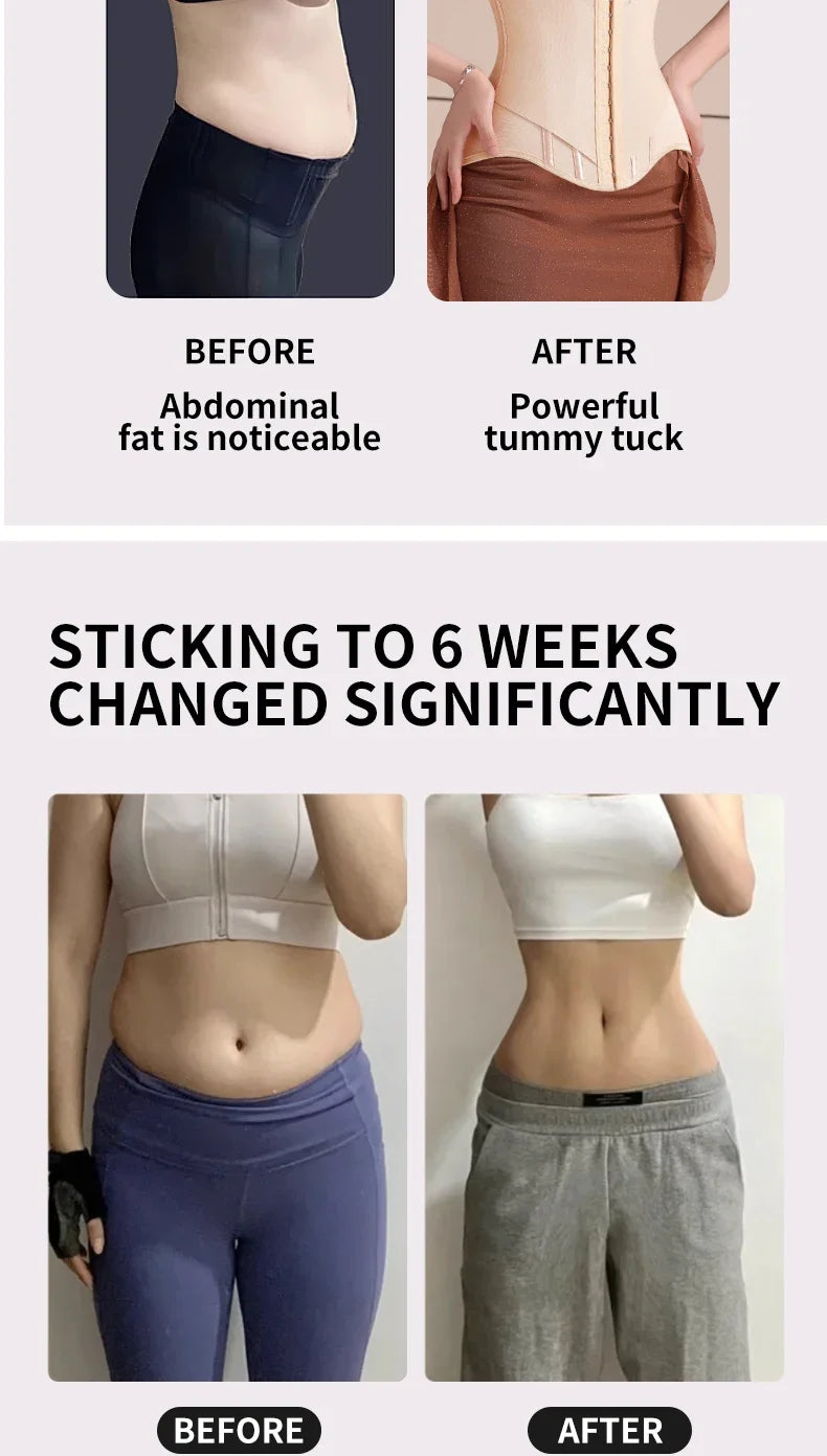 Signature U-Contour Breast Lift Corset™