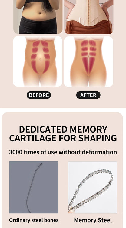 Signature U-Contour Breast Lift Corset™